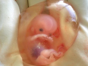 fetus_womb